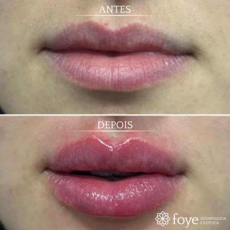 Modelo novo yasmin - 2025-06-25T155025.871